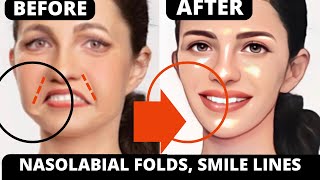 🛑 ANTIAGING FACE LIFT EXERCISES FOR JOWLS LAUGH LINES EYE BAGS DOUBLE CHIN SAGGY SKIN FOREHEAD [upl. by Fante]