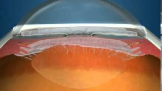 How Fluid Circulates in the Eye [upl. by Nybor]