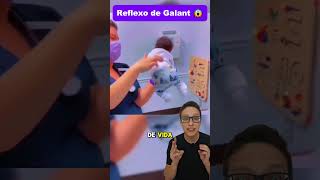 Reflexo de Galant😱👶 medicina medico pediatria enfermagem enfermeira pediatriaonline pediatra [upl. by Jakoba]