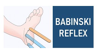 Babinski Reflex Plantar Reflex [upl. by Fornof411]