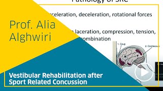 Vestibular Rehabilitation after Sport Related Concussion  Professor Alia Alghwiri [upl. by Grados]