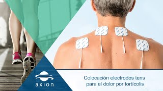 Colocación electrodos TENS para dolor de tortícolis  Electroestimulación TENS para terapia de dolor [upl. by Ula326]