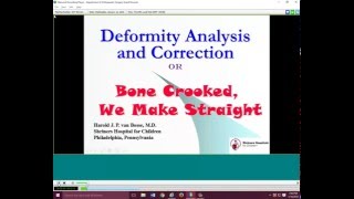 Deformity Analysis and Correction [upl. by Ilam991]