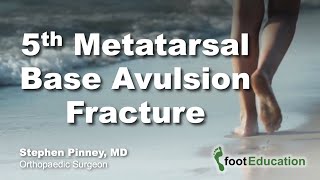 5th Metatarsal Base Avulsion Fracture [upl. by Anizor627]