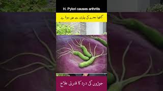 WARNING H Pylori Infection Could Be CAUSING Your Arthritis arthritis hpylori guthealth [upl. by Obeded]