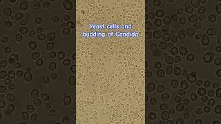 Yeast cells and budding of Candida [upl. by Tremann]