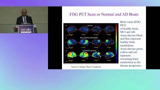 Newly FDA Approved Alzheimer’s Biomarkers Testing How to Implement Such Tests in Core Laboratory [upl. by Flynn304]