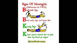 Sign Of Meningitis in Urdu Hindi [upl. by Raynah262]