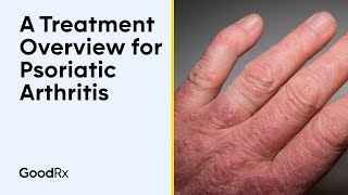 A Treatment Overview for Psoriatic Arthritis  GoodRx [upl. by Ahtelat]