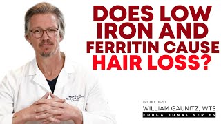 Anemia Hair Loss Iron Deficiency Low Ferritin and Hair Thinning [upl. by Nyraa717]