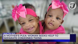 A Mothers Plea Woman Seeks help to Separate Conjoined Twins  TVJ News [upl. by Pavier]