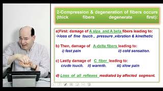 Sensory disturbances  Syringomyelia  Tabes dorsalis  Herpes zoster  peripheral neuritis [upl. by Elleiand890]