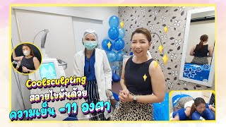 แม่แอนลดต้นแขน Coolsculpting สลายไขมันด้วยความเย็น 11 องศา [upl. by Yesoj]