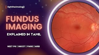 Fundus Imaging  Funduscopy  Explained in Tamil  NEET PG  INICET  MRB [upl. by Nahgam185]