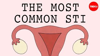 The most common STI in the world  Emma Bryce [upl. by Llenrahs]