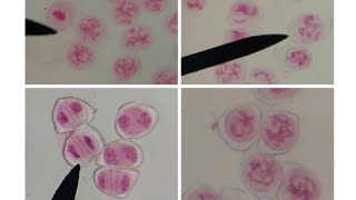 MEIOTIC CELL DIVISION STAGES FROM PERMANENT SLIDES SPECIMEN  GRASSHOPPER TESTIS [upl. by Enelegna]