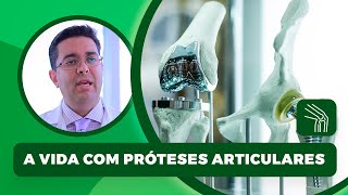 Artroplastia  Como é a vida com próteses articulares [upl. by Salvadore]