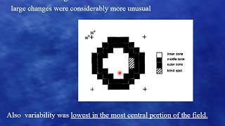 Field progression  which method to use part 1 [upl. by Andromache]