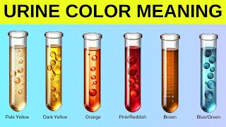 What Your Urine Color Says About Your Health‼️ [upl. by Neoma]