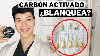 🔴 BLANQUEAMIENTO DENTAL CON CARBÓN ACTIVO  BLANQUEADOR DE DIENTES  EXPERIMENTO 100 COMPROBADO [upl. by Backer]