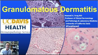 DERMATOPATHOLOGY Granulomatous Dermatitis [upl. by Rashidi]