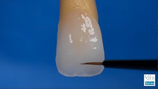 Creating Incisal Edge Effects on Monolithic Veneers and Crown [upl. by Ekoorb365]