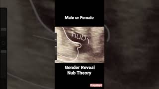 Guess the gender with nub theorybaby boy pregnancycare pregnancy ultrasound [upl. by Tnelc]