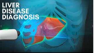 Liver Disease Diagnosis 3D medical animation 2022 [upl. by Folberth864]