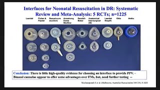 Dr Rangasamy Ramanathan  The Use of RAM Cannula for LBW infants [upl. by Nivad]