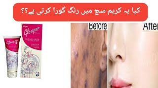 Glowpar whitening Cream Review  Medicated cream worth buying [upl. by Nyrmak753]