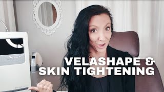 Does VelaShape tighten loose skin VelaShape Results amp Reviews [upl. by Wertz]