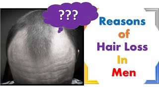 Causes of hair fall treatment for men Baldness Alopecia [upl. by Aynekal335]