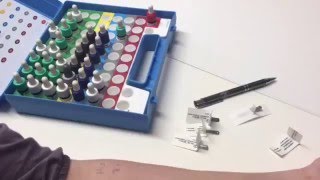 Allergietest  Prick Test [upl. by Ynohtnakram859]