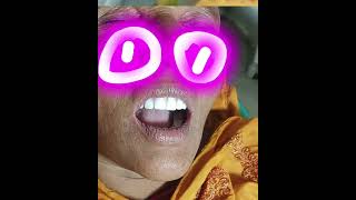 Full mouth dentureteeth denture [upl. by Annoyek]