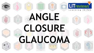 Gonioscopy Angle Closure [upl. by Heisser]