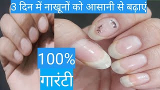 How To Grow Nails Fast  nails kaise badhaye  How to care nails at home [upl. by Dragde354]