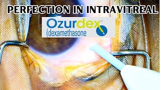 How to give intravitreal Ozurdex  Exercise right protocols from the beginning [upl. by Onirefes]