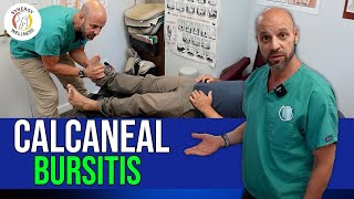 Calcaneal Bursitis  Ankle Pain [upl. by Lorrie]