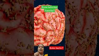 Naegleria Fowleri viralvideo science facts shortfeed shorts [upl. by Eliseo]