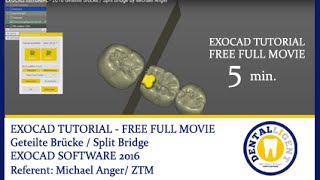 EXOCAD TUTORIAL  2016 Geteilte Brücke  Split Bridge by Michael Anger [upl. by Diahann219]