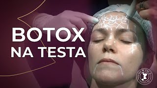 Botox na testa [upl. by Anyah]