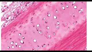 Histology of cartilages  light microscopic features and location [upl. by Aicetel]