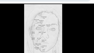 Mystery diagnosis Parry rhomburg syndrome [upl. by Naitirb]