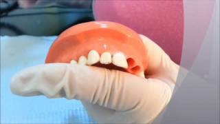 Dentistry  Operative dentistry class V [upl. by Aciret]