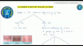 Orthodontics 3 Etiology of Malocclusion Classification of Malocclusion and Occlusion [upl. by Honora]