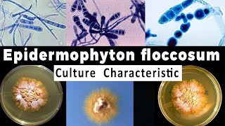 Epidermophyton Flocusum Culture Characteristic [upl. by Iak]