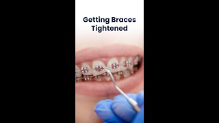 Whats the process of getting your braces tightened [upl. by Assirek]