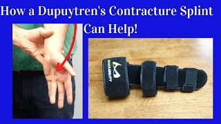 How a Dupuytrens Contracture Splint Helps [upl. by Ayaet]