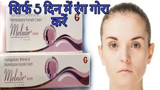 Melnor Skin Cream Review In Hindi [upl. by Eednas]