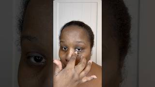 Get rid of hyperpigmentation skincare skincareroutine shorts skincareshorts skincareproducts [upl. by Buehler]